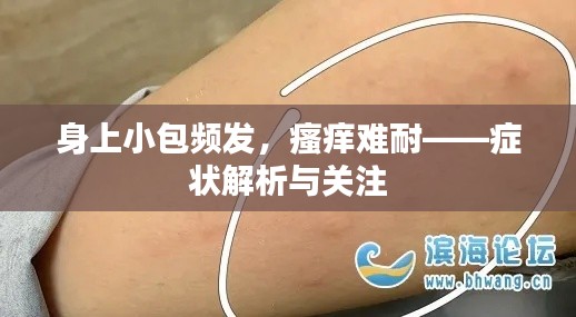 身上小包频发,瘙痒难耐——症状解析与关注